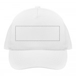 FRONT EMBROIDERY